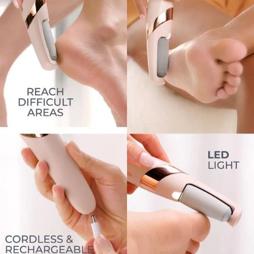 Rechargeable Electric Foot File & Callus Remover