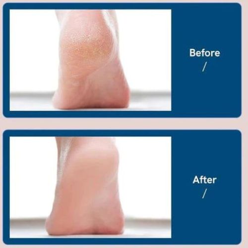 Rechargeable Electric Foot File & Callus Remover